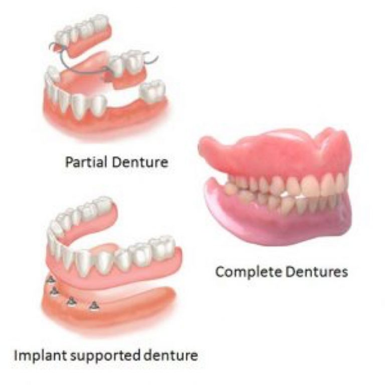 Dentures2