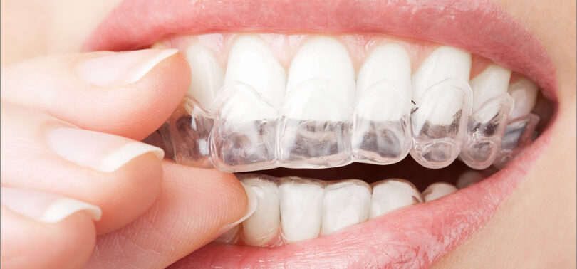 Orthodontics